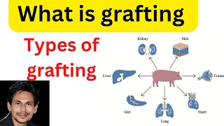 tissue graftinggraftingwhat is graftingtypes of graftingautograftisograftallograftxeno [upl. by Prent]