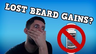 Minoxidil Beard Journey I Took A Break [upl. by Quigley]