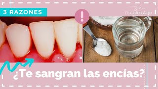 ENCIAS SANGRANTES E INFLAMADAS [upl. by Gant]