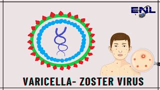 Varicella Zoster Virus  Microbiology  Explanation in Hindi [upl. by Allveta]