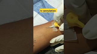 Iv cannulations💉 cannulation ytshortsindia cannulation mujjuu14 MiaBiwiWinees [upl. by Carissa]