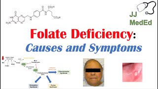 Folate Deficiency Causes ex medications Pathogenesis Symptoms Diagnosis and Treatment [upl. by Nohtanoj]