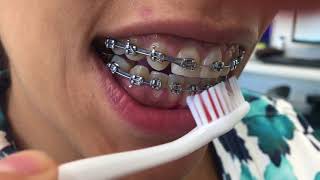 Cepillado de dientes con Brackets [upl. by Eillas]