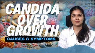 Candida Overgrowth Causes Risk Factors and How to Keep It in Check  Dt Vineesha Reddy [upl. by Aicirtan]