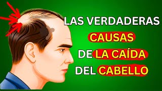 Causas y soluciones naturales para la caída del cabello Guía completa [upl. by Einaeg922]