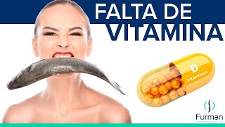 10 Señales de Deficiencia Vitamina D que Jamas debes ignorar Vitamina D baja [upl. by Naid]