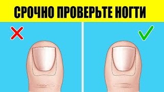 На какие болезни указывают Цвет и Форма Ногтей [upl. by Gavin]