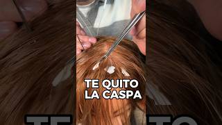 TE QUITO LA CASPA asmr shorts asmrvideo comedia [upl. by Aleafar397]