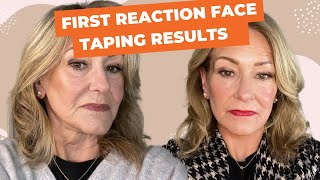 Face Taping Before and After A StepbyStep Guide and is it Right for you [upl. by Ivan]