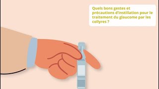 Tutoriel – Comment instiller son collyre pour le glaucome​ [upl. by Herrah940]