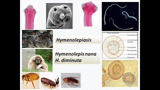 Hymenolepis nanaHymenolepis diminuta infection or Hymenolepiasis in humans and rodents AZ [upl. by Clement]