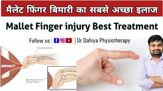 Mallet Finger injury Best Treatment  मैलेट फिंगर का सबसे अच्छा इलाज  Dr Dahiya Physiotherapy [upl. by Adnauqaj]