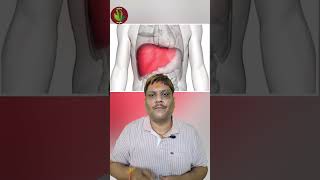 hepatomegaly hepatomegalyremedies hepatomegalycure enlargeliver fattyliver यकृतवृद्धि [upl. by Grew]