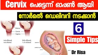 Cervix Dilating Exercise MalayalamNatural Way To Induce LaborDelivery Tips [upl. by Anattar]