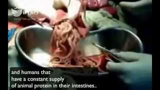 Removing intestinal worms amp parasites from a bodybuilders colon re [upl. by Gomar330]