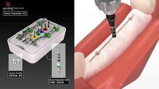 Bone Expander Kit  Haenaem Co Ltd [upl. by Jorge664]