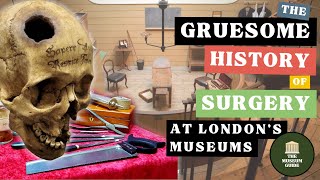 The Gruesome History of Surgery in Londons Museums  A Tour of The Old Operating Theatre amp 4 others [upl. by Rozele]