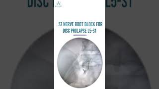 S1 Nerve Root Injection For Disc Prolapse  L5 S1 Under Fluoroscopy Guidance [upl. by Moll]