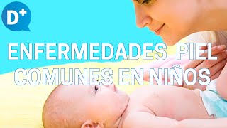 Enfermedades de la piel más comunes en niños [upl. by Hawthorn]