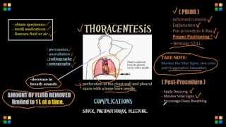 Thoracentesis NCLEX Review Important Content [upl. by Suivatco]