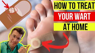 Doctor explains how to treat WARTS at home plus when to seek medical attention [upl. by Shaikh]