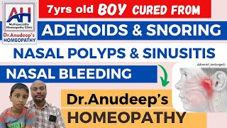 BEST HOMEOPATHY TREATMENT FOR ADENOIDSSINUSITISNASAL POLYPSSNORINGNOSE BLEEDING CURED IN 7yr OLD [upl. by Meraree]