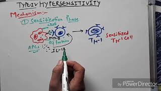 Hypersensitivity type 4 hindi [upl. by Amie]