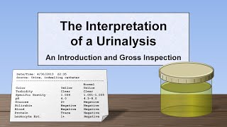 Interpretation of the Urinalysis Part 1  Introduction and Inspection [upl. by Dublin15]