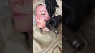 MICRONEEDLING BY YANABEAUTE biologiquerecherche microneedling [upl. by Cohla124]