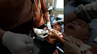 Polydactyly removal procedure by cautery mbbsaiimsdoctor bamsytshortsyoutubeshortsnursing [upl. by Esau]