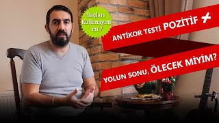 COVID19 Antikor Testi Pozitif Ölecek Miyim IGG ve IGM Sonuçları Korona Diyor [upl. by Aikahs]