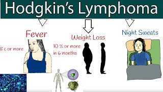 Hodgkins lymphoma Hodgkins disease  Symptoms and treatment How to detect lymphoma [upl. by Laehpar]