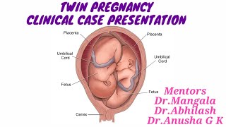 TWIN PREGNANCY Clinical case presentation [upl. by Khan]