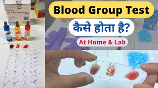 Blood Group Test in Hindi  Blood Group Test At HomeMLTLabManual20 [upl. by Nosecyrb]