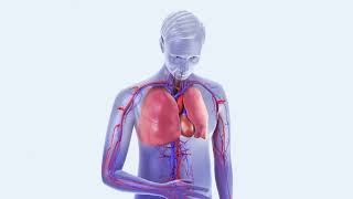 Tiefe Venen Thrombose und Lungenembolie [upl. by Davies]