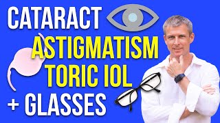 Cataract astigmatism toric IOL glasses and IOL selection [upl. by Aetnuahs]