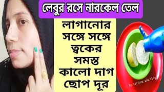 ১ রাতেই কালো দাগ মেছতা থেকে মুক্তিMukher kalo dag dur korar upaySkin Whitening serum [upl. by Eesak986]