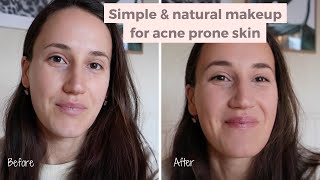 Simple amp Natural Makeup For AcneProne Skin [upl. by Lananna]