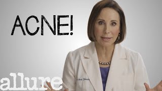 What is Acne and How Do I Get Rid of it Forever  Allure [upl. by Noirod]