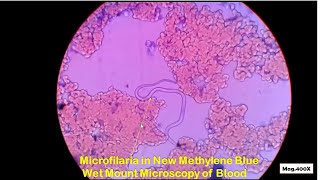 Microfilaria in blood Microscopy [upl. by Annoyed932]