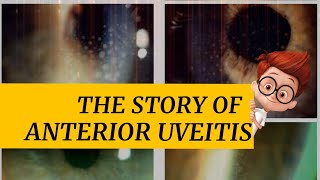 The story of ANTERIOR UVEITIS  iritis cyclitis and iridocyclitis  Signs amp symptoms and more [upl. by Kirkpatrick]