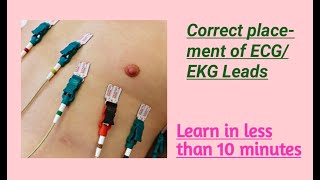 12 leads ECG Leads placement how to attach EKG leads in Urdu Hindi [upl. by Eednak]