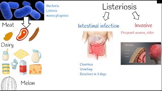 listeriosis  Symptoms and treatment Listeria monocytogenes [upl. by Onitnatsnoc]