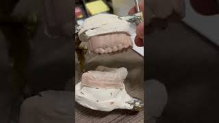 TMD Orthotic Fabrication  Video 6 [upl. by Ahtanoj]