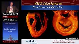 Mitral Stenosis Stephen H Little MD Sunday August 21 2016 [upl. by Accem100]