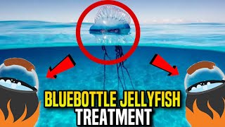 Bluebottle Jellyfish Stings What You Need to Know amp How to Treat Them [upl. by Aniarrol]