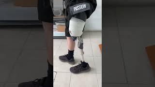 Transfemoral amputee rehab shorts legprosthesis prosthesis artificialleg prosthetics [upl. by Karlan]