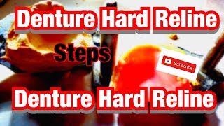 Dentures Hard Reline Instructions [upl. by Conah850]