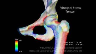 Quantitative CTbased Finite Element Analysis of Hip joint [upl. by Thrasher479]