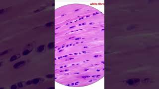 cartilage histo slides Can you recall the zones in epiphyseal cartilageneetpg inicet neet 1 [upl. by Igor504]